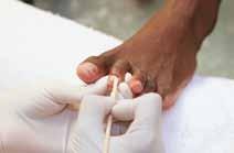 12 caution 12 Carefully remove the cuticle tissue from the nail plate using a wooden or metal pusher, staying away from the eponychium and taking care not to break the seal between the nail plate and