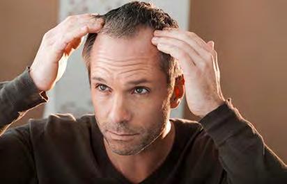 Stress can cause your hair to literally fall out. Usually, the hair loss occurs 3 months after you`ve gone through a stressful period.