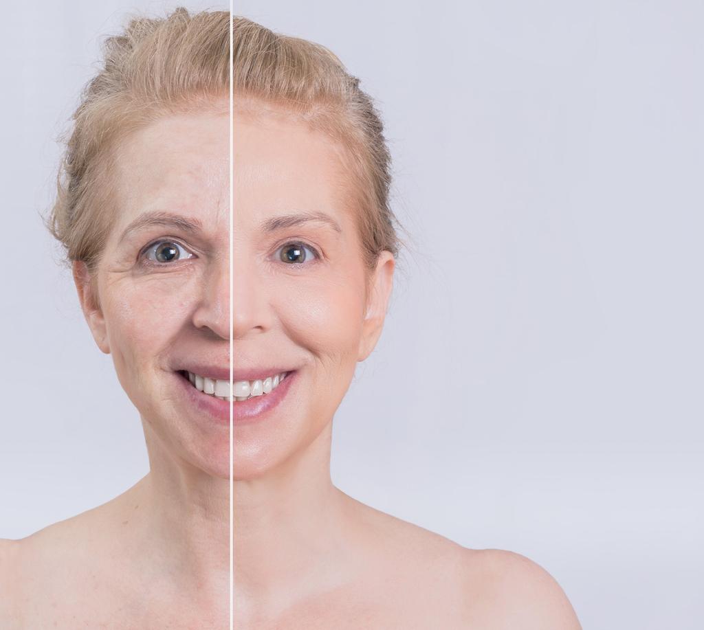 face, and creating the desired youthful