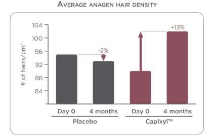 Results: Anagen and Telogen hair density More than 70% of the