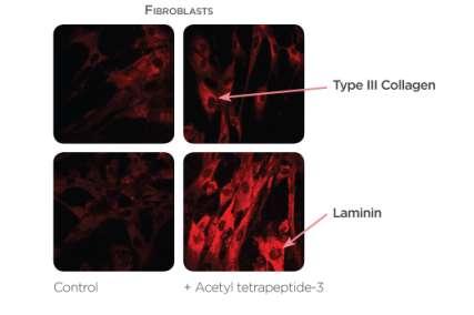 Acetyl tetrapeptide-3 & Proteins synthesis Acetyl tetrapeptide-3 induces the synthesis of laminin, type III collagen in fibroblasts