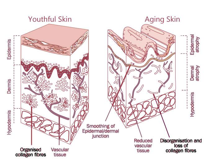 Appearance of the Skin Skin Changes Overtime: Increase in wrinkle formation