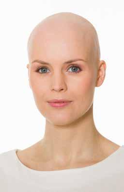 WHY DOES CHEMOTHERAPY CAUSE HAIR LOSS? Cancer cells are known to divide frequently. This is what causes cancer to spread and to travel.