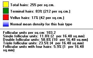 Hair diameter: Measured total: 40 hairs per 16.48 sq.mm Mean diameter: All hairs 58 +/- 2.9 µm Mean diameter: All Terminal hairs (>40 µm) 63 +/- 2.