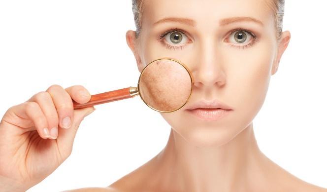 Adult On-Set Acne What is Adult On-set Acne? Acne usually starts in puberty, but it affects adults too. There are many myths about what causes it. Here are the facts and details of treatments.