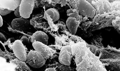 Despite its significance in shaping human history, the origin of the plague remains shrouded in mystery - but the new discovery has pushed its age back by at least 1,000 years older.