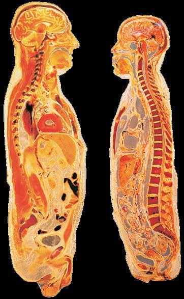 above: Midsagittal slices of a male (left) and female (right) body. training to properly interpret personal information about their own bodies and that this knowledge could do more harm than good.