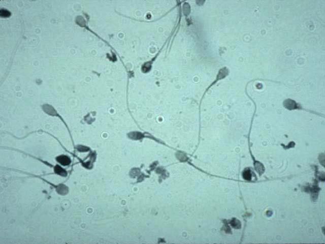 Sperm Cells Sperm cells
