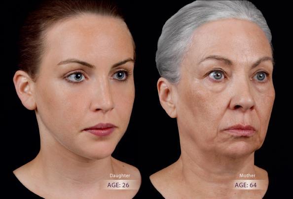 Aging: What Happens To The Face?