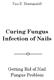 Curing Fungus Infection of Nails